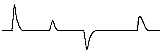 故障導(dǎo)體的測量波形