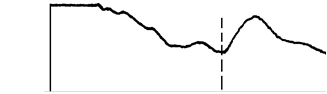 無內(nèi)部平衡網(wǎng)絡(luò),儀器增益過大